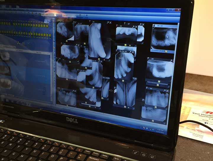 Digital Dental Radiology